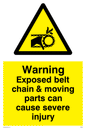 WM5604: Exposed belt chain can cause severe injury
