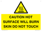 WK12631: CAUTION HOT SURFACE WILL BURN SKIN DO NOT TOUCH