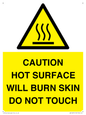 WK12631: CAUTION HOT SURFACE WILL BURN SKIN DO NOT TOUCH