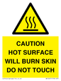 WK12631: CAUTION HOT SURFACE WILL BURN SKIN DO NOT TOUCH