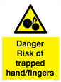 WM10836: Danger Risk of trapped hand/fingers