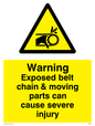 WM5604: Exposed belt chain can cause severe injury